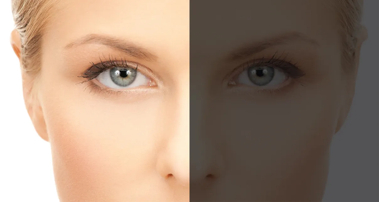 Primo piano di un volto femminile diviso a metà: lato sinistro nitido, lato destro sfocato a rappresentare una differenza di visione.