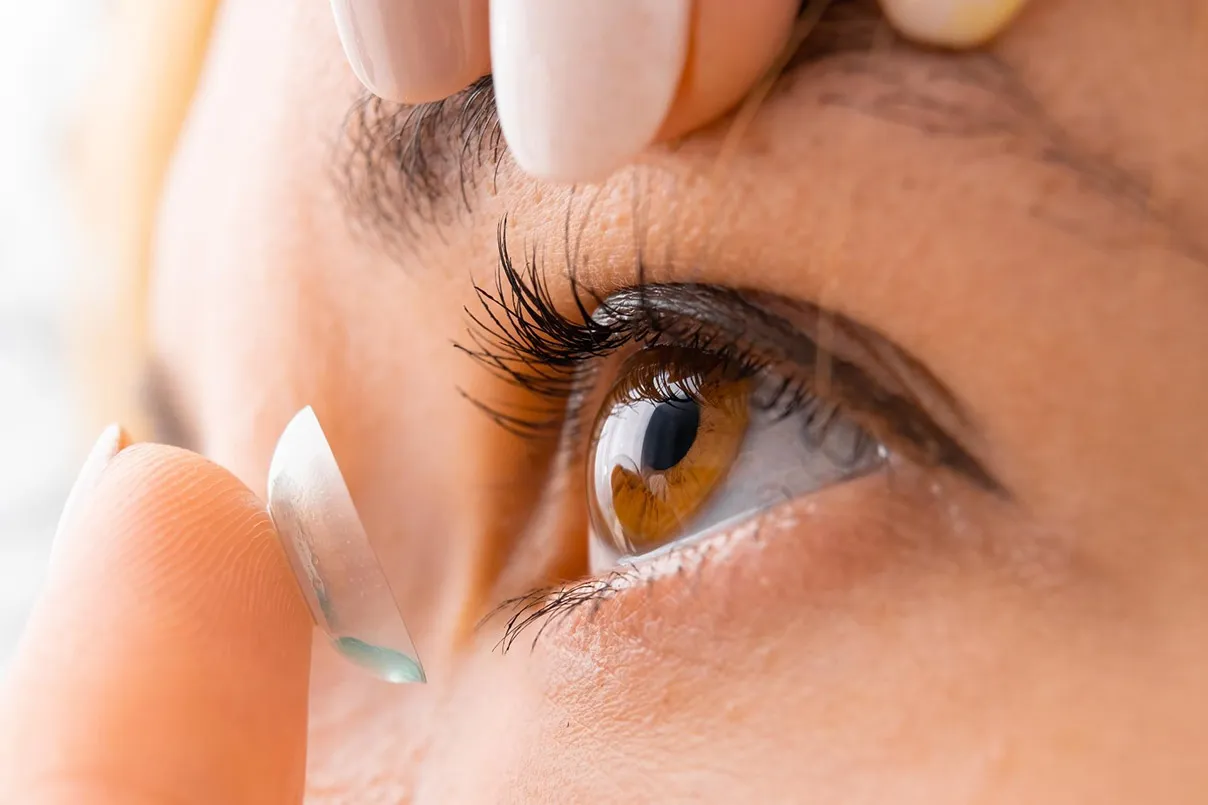 Applicazione lente per cheratocono su occhio sinistro